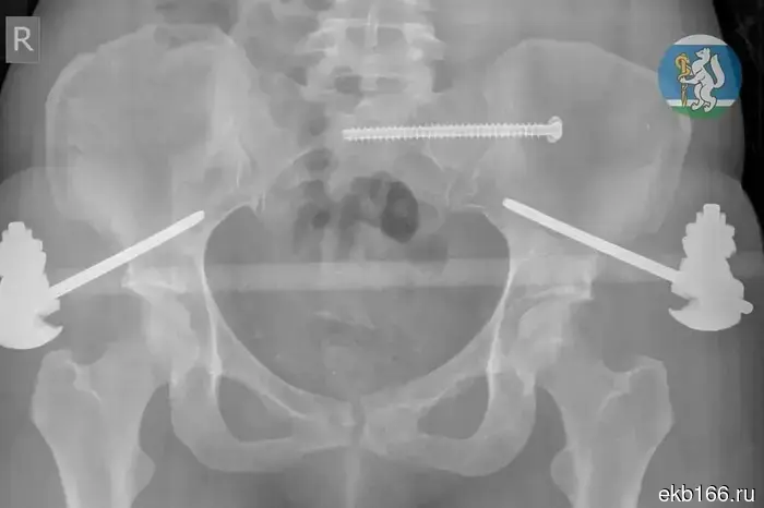 A Yekaterinburg resident survived after falling from the 7th floor while washing windows.