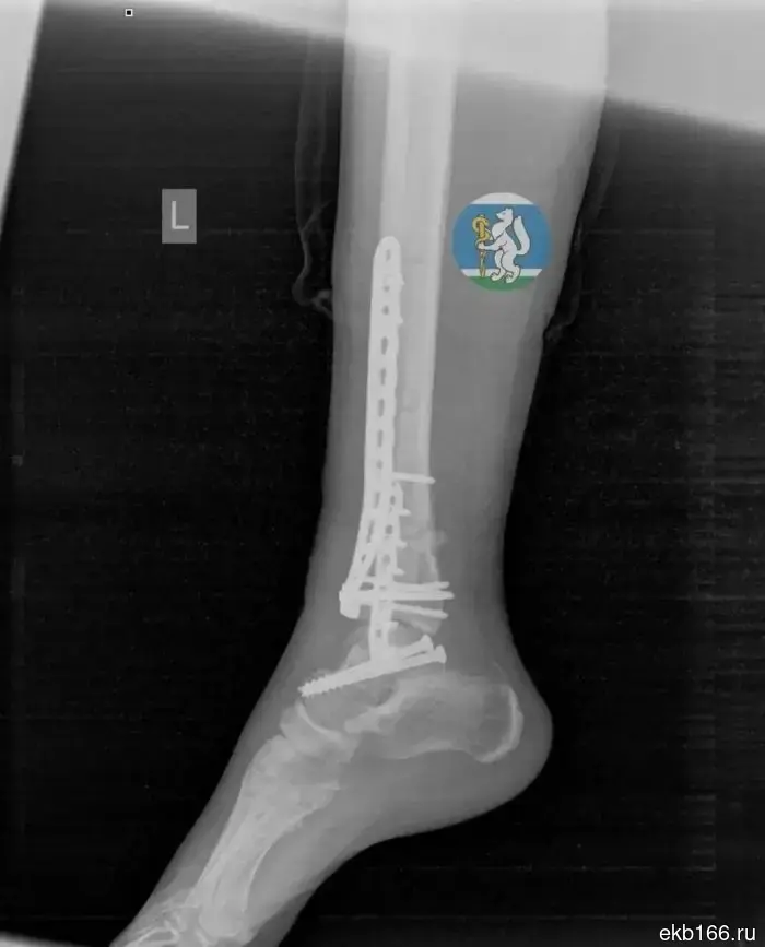 A Yekaterinburg resident survived after falling from the 7th floor while washing windows.