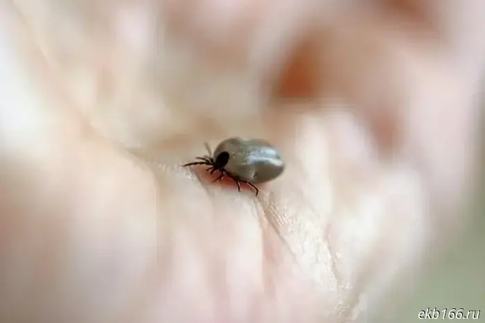 Sverdlovsk residents are being swarmed by ticks.